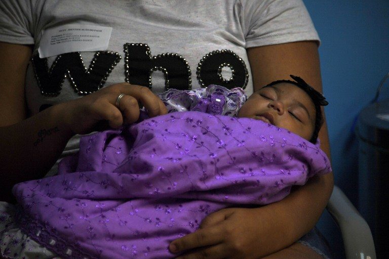 BRAZIL-ZIKA-BABIES-MICROCEPHALY